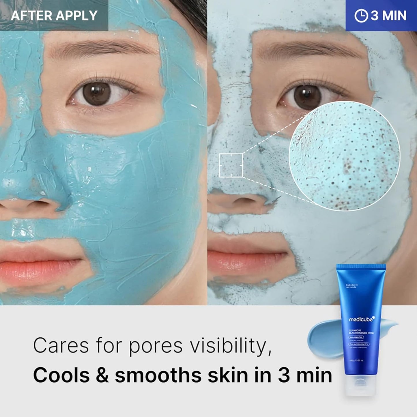 Medicube Zero Pore Blackhead Mud Mask 100 g (3.52 oz)