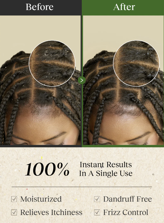 Bephor Braid Rev Scalp Cleansing Toner 200 mL (6.67 fl oz)