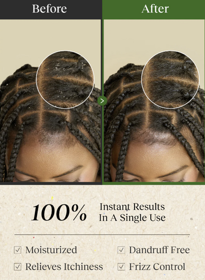 Bephor Braid Rev Scalp Cleansing Toner 200 mL (6.67 fl oz)