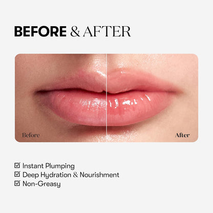 VT Cosmetics Reedle Shot Lip Plumper Beginner 4.3 g (0.15 oz)