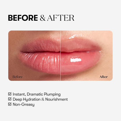 VT Cosmetics Reedle Shot Lip Plumper Expert 4.3 g (0.15 oz)